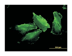 methionyl-tRNA synthetase, Mouse, Clone: 5G5, Abnova 100&mu;g; Unlabeled:Anticuerpos