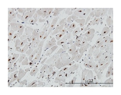 methyl CpG binding protein 2 (Rett syndrome), Mouse, Clone: 4B6, Abnova