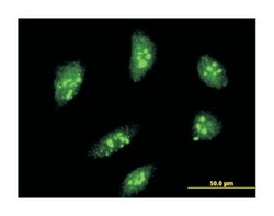 MEOX2, Mouse, Clone: 4E10, Abnova 100&mu;g; Unlabeled:Antibodies, Monoclonal