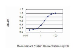 SCGB2A1, Mouse, Clone: 2E2, Abnova 100 &mu;g | Buy Online | Abnova Corporation | Fisher Scientific