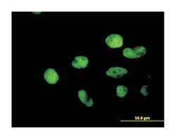 mutS homolog 2, colon cancer, nonpolyposis type 1 (E. coli) (B01), Mouse