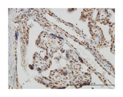 musashi homolog 1 (Drosophila), Mouse, Clone: 3F2, Abnova 100 &mu;g | Buy Online | Abnova Corporation | Fisher Scientific