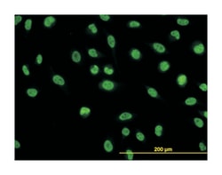nuclear factor I/C (CCAAT-binding transcription factor), Mouse, Clone: 1D6, Abnova&trade;