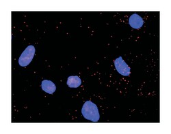 nuclear factor of kappa light polypeptide gene enhancer in B-cells 1, Rabbit,