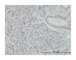 nuclear factor of kappa light polypeptide gene enhancer in B-cells 1, Mouse,