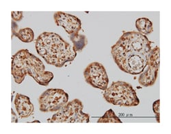 nonmetastatic cells 1, protein (NM23A) expressed in, Mouse, Clone: 1D7,