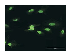paired box 2, Rabbit, Purified MaxPab Polyclonal Antibody, Abnova 100 &mu;g | Buy Online | Abnova | Fisher Scientific