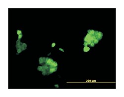 progesterone receptor, Mouse, Clone: 2C2, Abnova 100&mu;g; Unlabeled:Antibodies,