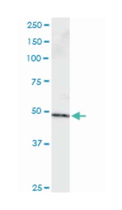 PPP2R2B, Mouse, Clone: 1B10, Abnova 100 &mu;g | Buy Online | Abnova Corporation | Fisher Scientific