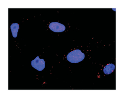 mitogen-activated protein kinase 11, Rabbit, Purified MaxPab Polyclonal
