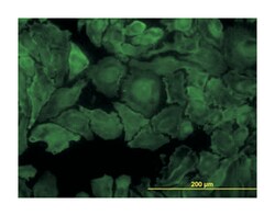 PTK7 protein tyrosine kinase 7, Mouse, Clone: 4C6, Abnova 100&mu;g; Unlabeled:Antibodies,