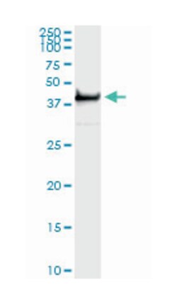 twinfilin, actin-binding protein, homolog 1 (Drosophila), Mouse, Clone: