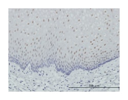 retinoic acid receptor, alpha, Mouse, Clone: 2D2, Abnova 100&mu;g; Unlabeled:Antibodies,