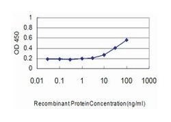 anti-SMN2, Clone: 2B11-2A9, Abnova 100 &mu;g | Buy Online | Abnova Corporation | Fisher Scientific
