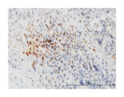 tyrosine kinase 2, Mouse, Clone: 5A4, Abnova 100 &mu;g | Buy Online | Abnova | Fisher Scientific