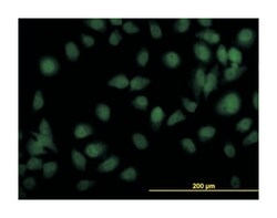 tyrosine kinase 2, Mouse, Clone: 5A4, Abnova 100 &mu;g | Buy Online | Abnova | Fisher Scientific