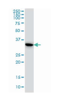 thymidylate synthetase, Mouse, Clone: 3A1, Abnova™
