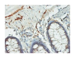 UCHL1, Mouse, Clone: 1B8-4D2, Abnova 100 &mu;g | Buy Online | Abnova Corporation | Fisher Scientific