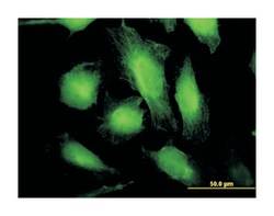 tryptophanyl-tRNA synthetase, Mouse, Clone: 3A12, Abnova 100&mu;g; Unlabeled:Antibodies,