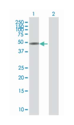 zinc finger and BTB domain containing 25, Mouse, Polyclonal Antibody, Abnova