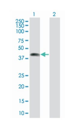 zinc finger protein 187, Mouse, Polyclonal Antibody, Abnova 50&mu;L; Unlabeled:Antibodies,