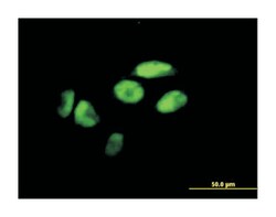 zinc finger protein 187, Mouse, Polyclonal Antibody, Abnova 50&mu;L; Unlabeled:Antibodies,