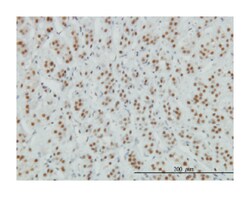 zinc finger protein 207, Mouse, Clone: 6D7, Abnova 100&mu;g; Unlabeled:Antibodies,