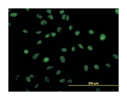 zinc finger protein 207, Mouse, Clone: 6D7, Abnova 100&mu;g; Unlabeled:Antibodies,