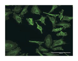 zyxin, Rabbit, Purified MaxPab Polyclonal Antibody, Abnova 100&mu;g; Unlabeled:Antibodies,