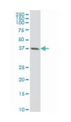 CXCR4 (M02A), Mouse anti-Human, Clone: 1F8, Abnova 200 &mu;L | Buy Online | Abnova | Fisher Scientific