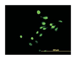 nuclear receptor subfamily 4, group A, member 3, Mouse, Clone: 1E9, Abnova