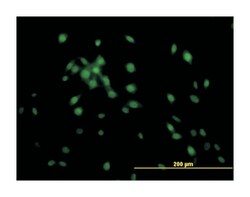 Kruppel-like factor 11, Mouse, Clone: 10D8, Abnova&trade;