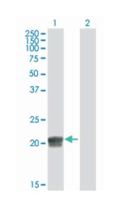 regulator of G-protein signaling 5, Mouse, Purified MaxPab Polyclonal Antibody, Abnova 50 &mu;g | Buy Online | Abnova | Fisher Scientific