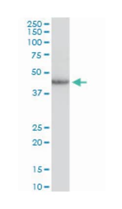 COP9 constitutive photomorphogenic homolog subunit 3 (Arabidopsis), Mouse,