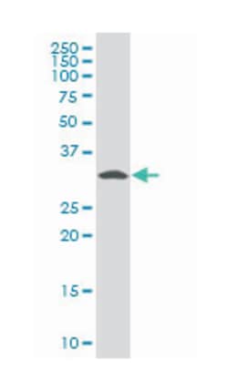 pyridoxal (pyridoxine, vitamin B6) kinase (A01), Mouse anti-Human, Polyclonal Antibody, Abnova 50 &mu;L | Buy Online | Abnova Corporation | Fisher Scientific