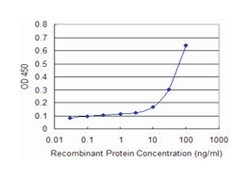 protein kinase, interferon-inducible double stranded RNA dependent activator,