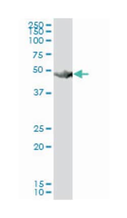 HARS (B01), Mouse anti-Human, Polyclonal Antibody, Abnova 50 &mu;L | Buy Online | Abnova Corporation | Fisher Scientific