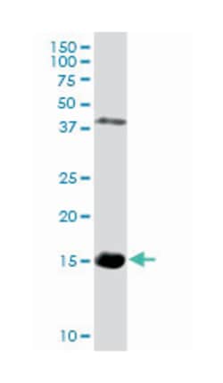 hemoglobin, zeta, Rabbit, Purified MaxPab Polyclonal Antibody, Abnova 100&mu;g;