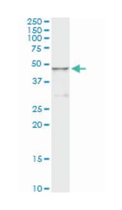 HGD, Mouse, Clone: 1F1, Abnova 100&mu;g; Unlabeled:Antibodies, Monoclonal