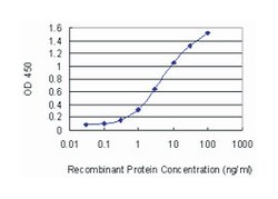 UBE2K, Mouse, Clone: 1D10, Abnova 100 &mu;g | Buy Online | Abnova Corporation | Fisher Scientific