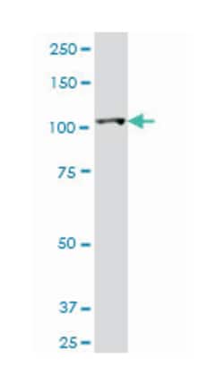 HK2, Mouse, Clone: 4H1, Abnova 100&mu;g; Unlabeled:Antibodies, Monoclonal