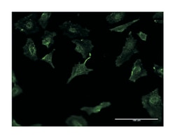 HLA-DMB, Mouse, Clone: 2D3, Abnova 100&mu;g; Unlabeled:Antibodies, Monoclonal