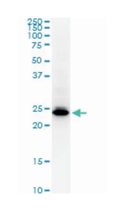 HMGB2, Mouse, Clone: 3F2, Abnova 200 &mu;L | Buy Online | Abnova | Fisher Scientific