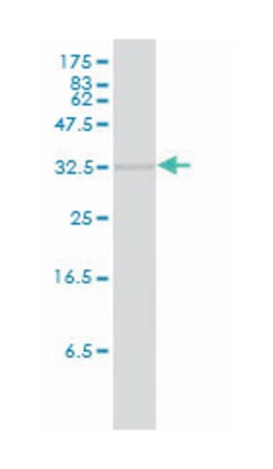 heme oxygenase (decycling) 2, Mouse, Clone: 1D8-1A8, Abnova&trade;