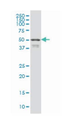 forkhead box A2, Mouse, Clone: 7E6, Abnova 100&mu;g; Unlabeled:Antibodies,