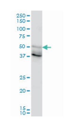 forkhead box A2, Mouse, Clone: 1C7, Abnova 100&mu;g; Unlabeled:Antibodies,