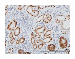 forkhead box A2, Mouse, Clone: 1C7, Abnova 100&mu;g; Unlabeled:Antibodies,