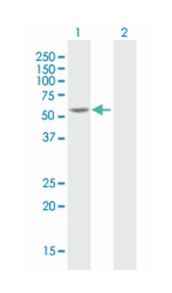 HNF4A, Mouse, Polyclonal Antibody, Abnova 50 &mu;g | Buy Online | Abnova | Fisher Scientific