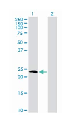 hippocalcin, Mouse, Purified MaxPab Polyclonal Antibody, Abnova 50 &mu;g | Buy Online | Abnova Corporation | Fisher Scientific