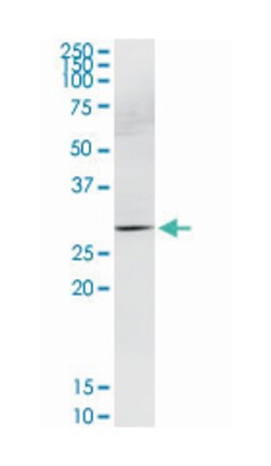 homeobox B9, Rabbit, Purified MaxPab Polyclonal Antibody, Abnova 100&mu;g;